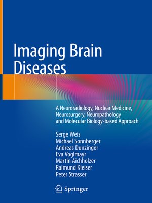 cover image of Imaging Brain Diseases